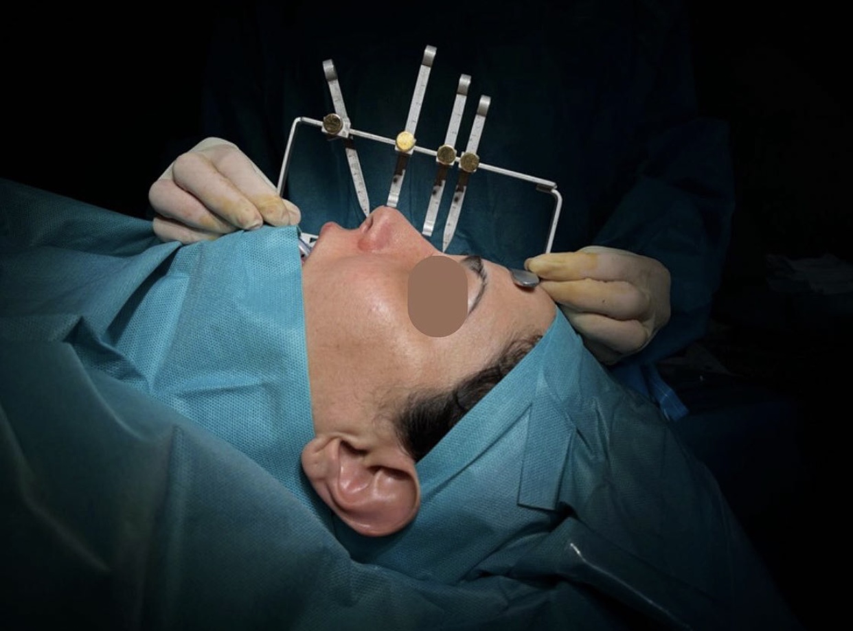 Dr Callum Faris - Facial Plastic Surgeon